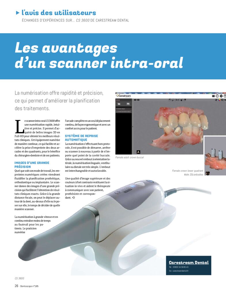 thumbnail of Les avantages d’un scanner intra-oral