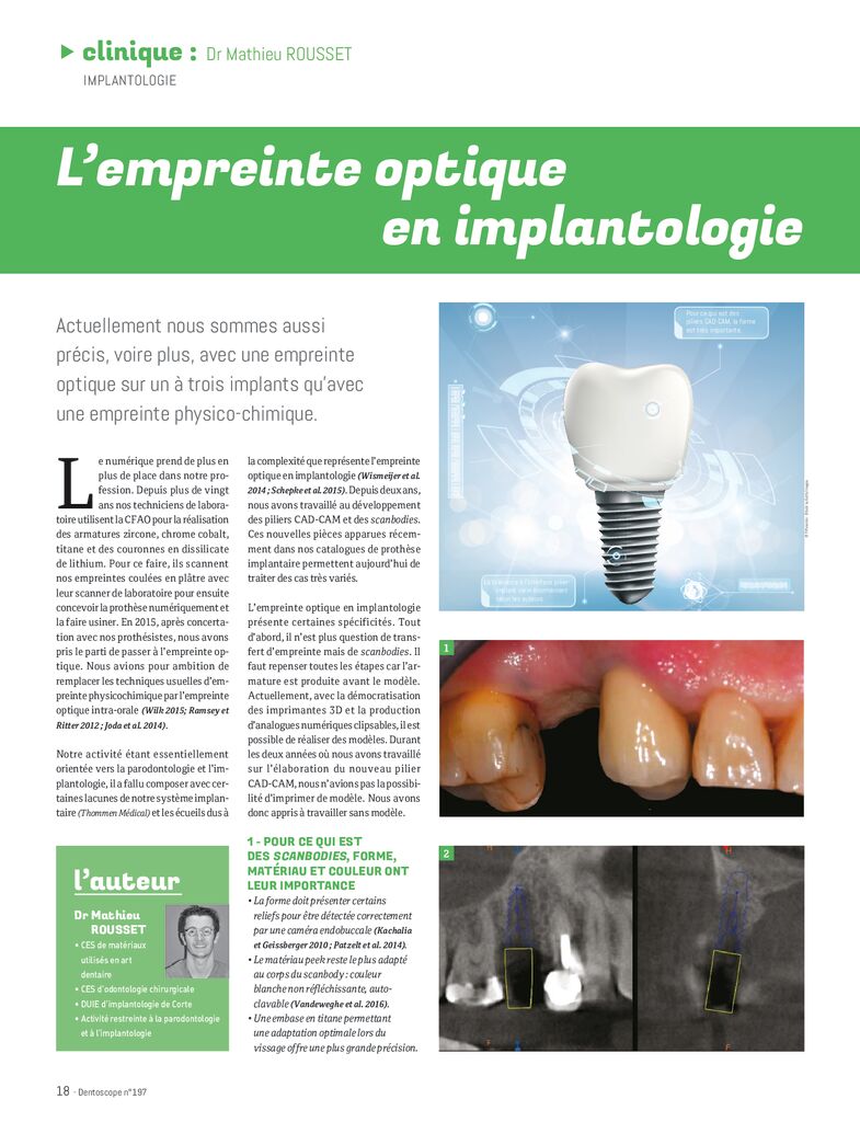 thumbnail of Lempreinte-optique-en-implantologie